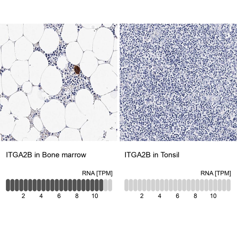 Integrin alpha 2b/CD41 Antibody - BSA Free Immunohistochemistry-Paraffin: Integrin alpha 2b/CD41 Antibody - BSA Free [NBP1-84580]