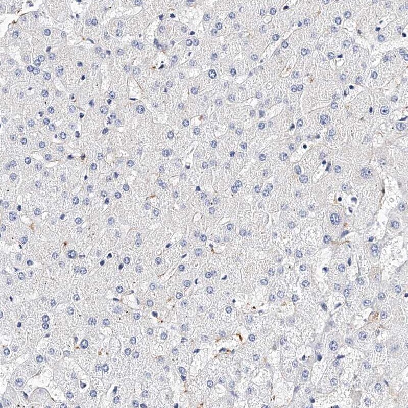 Integrin alpha 2b/CD41 Antibody - BSA Free Immunohistochemistry-Paraffin: Integrin alpha 2b/CD41 Antibody - BSA Free [NBP1-84580]