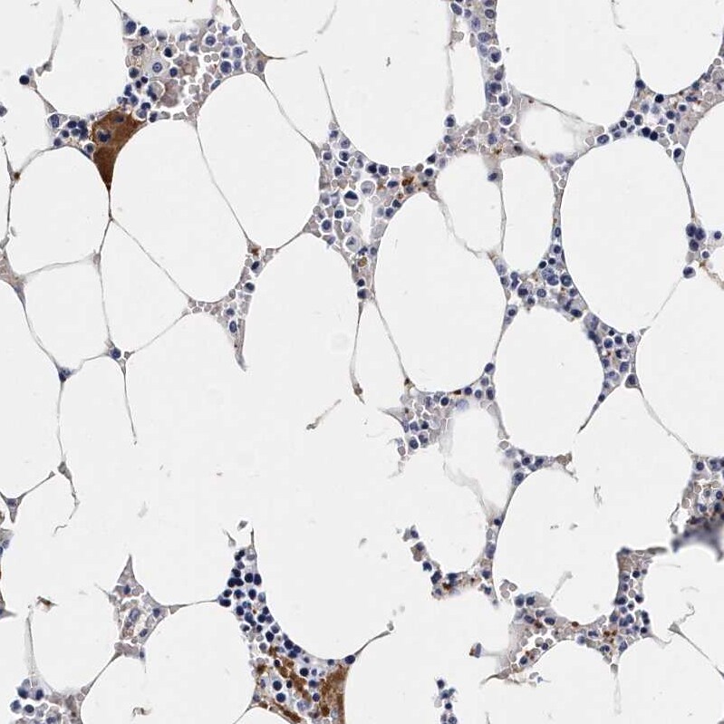 Integrin alpha 2b/CD41 Antibody - BSA Free Immunohistochemistry-Paraffin: Integrin alpha 2b/CD41 Antibody - BSA Free [NBP1-84582]