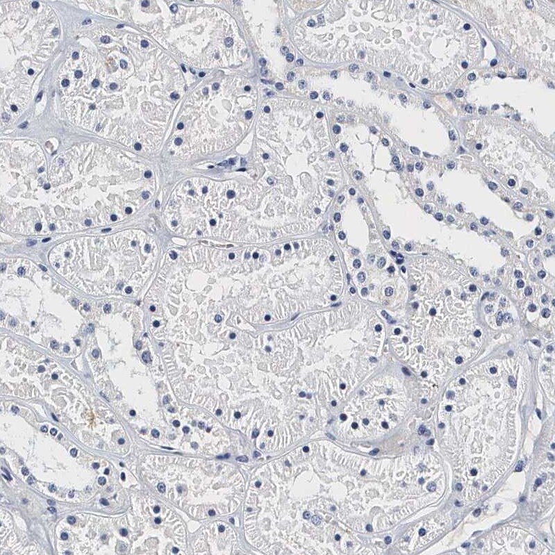 Integrin alpha 2b/CD41 Antibody - BSA Free Immunohistochemistry-Paraffin: Integrin alpha 2b/CD41 Antibody - BSA Free [NBP1-84582]