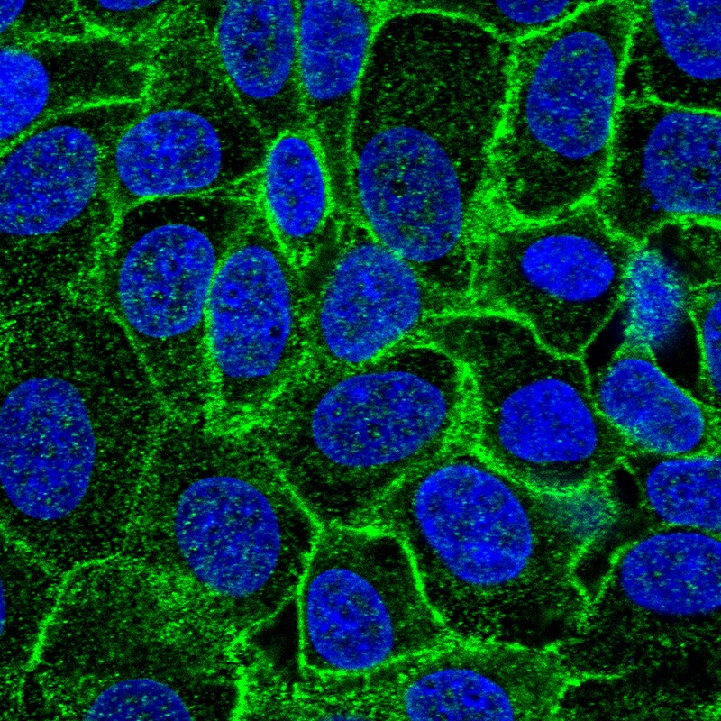 ErbB2/Her2 Antibody - BSA Free Immunocytochemistry/ Immunofluorescence: ErbB2/Her2 Antibody - BSA Free [NBP1-84584]