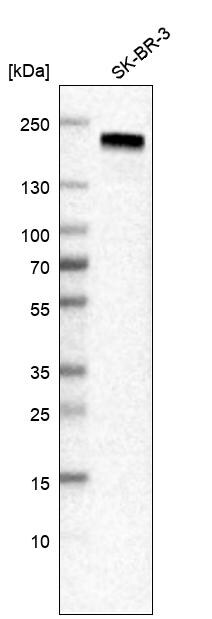 ErbB2/Her2 Antibody - BSA Free Western Blot: ErbB2/Her2 Antibody - BSA Free [NBP1-84584]