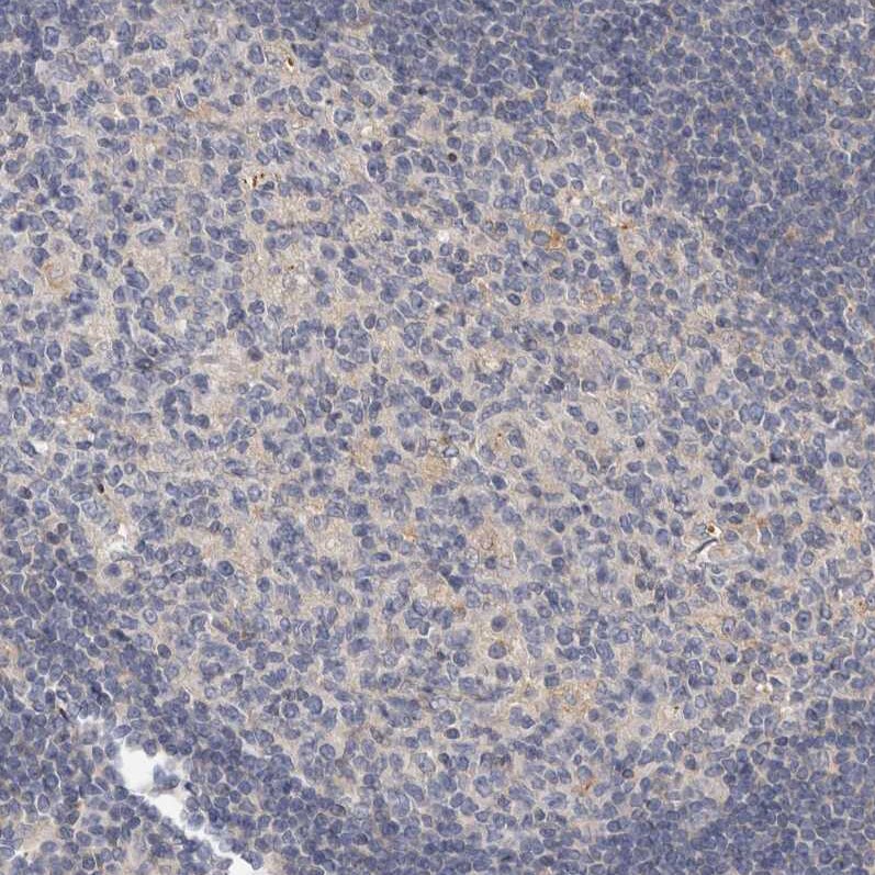FGFR4 Antibody - BSA Free Immunohistochemistry-Paraffin: FGFR4 Antibody - BSA Free [NBP1-84585]