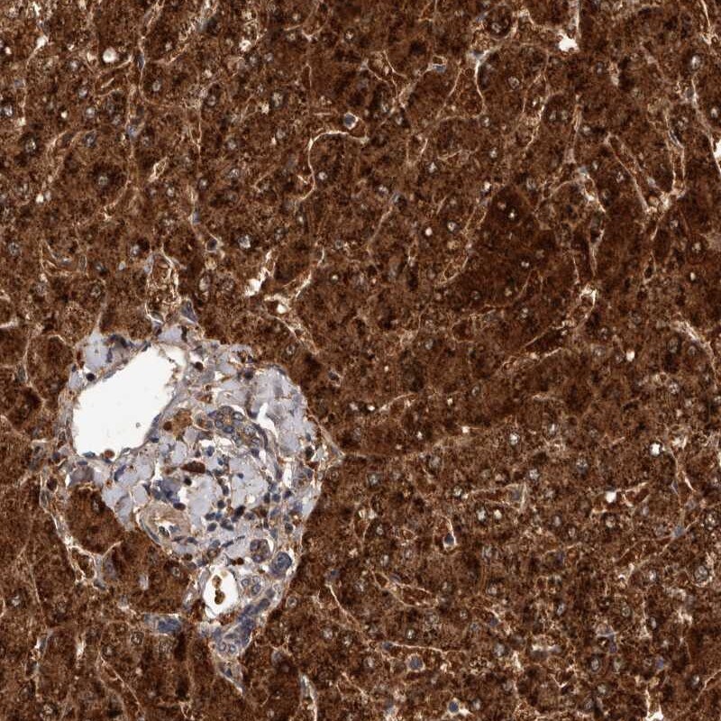 FGFR4 Antibody - BSA Free Immunohistochemistry: FGFR4 Antibody - BSA Free [NBP1-84586]