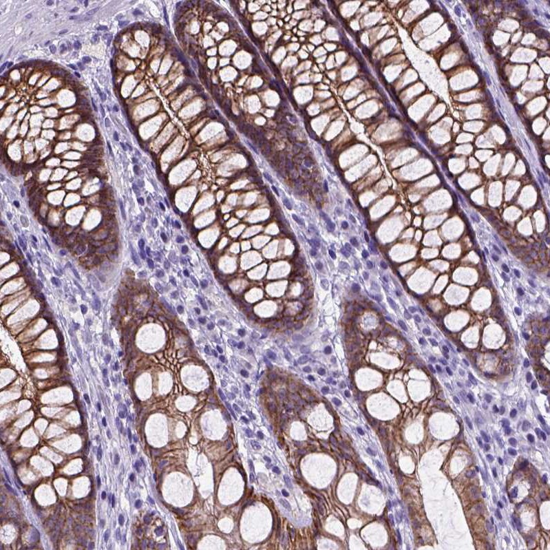 E-Cadherin Antibody - BSA Free Immunohistochemistry-Paraffin: E-Cadherin Antibody - BSA Free [NBP1-84588]