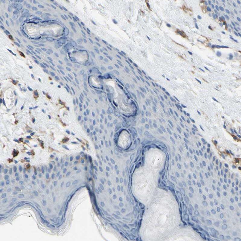 Fc gamma RIIA/CD32a Antibody - BSA Free Immunohistochemistry-Paraffin: Fc gamma RIIA/CD32a Antibody - BSA Free [NBP1-84589]
