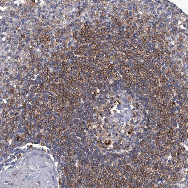TACI/TNFRSF13B/CVID Antibody - BSA Free Immunohistochemistry-Paraffin: TACI/TNFRSF13B/CVID Antibody - BSA Free [NBP1-84596]