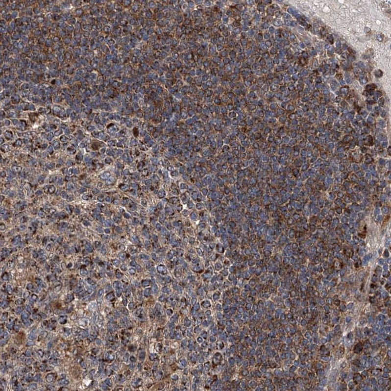 TACI/TNFRSF13B/CVID Antibody - BSA Free Immunohistochemistry-Paraffin: TACI/TNFRSF13B/CVID Antibody - BSA Free [NBP1-84596]