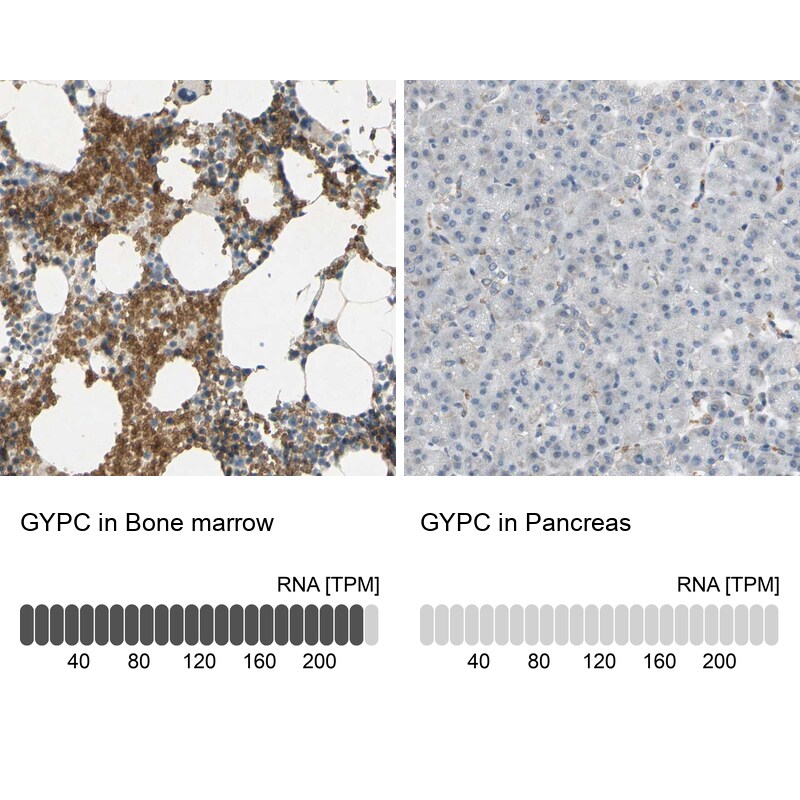 Glycophorin C Antibody - BSA Free Immunohistochemistry-Paraffin: Glycophorin C Antibody [NBP1-84597]