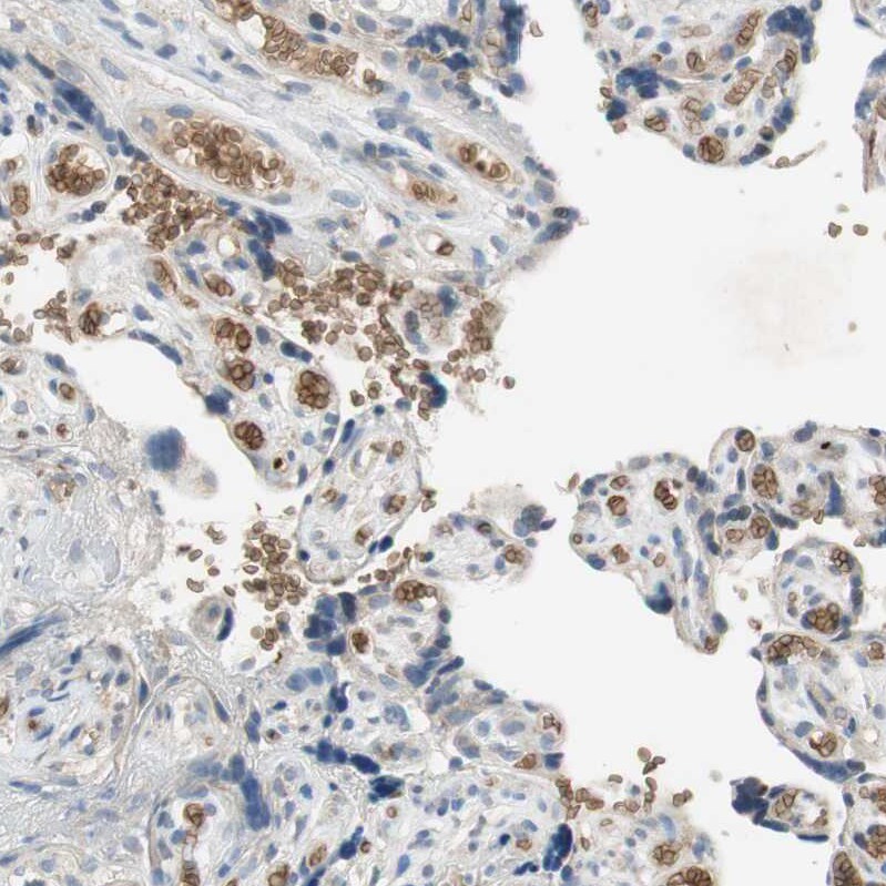 Glycophorin C Antibody - BSA Free Immunohistochemistry-Paraffin: Glycophorin C Antibody [NBP1-84597]