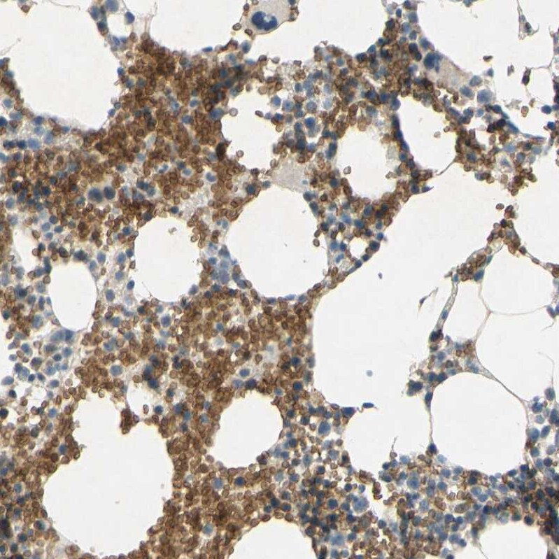 Glycophorin C Antibody - BSA Free Immunohistochemistry-Paraffin: Glycophorin C Antibody [NBP1-84597]