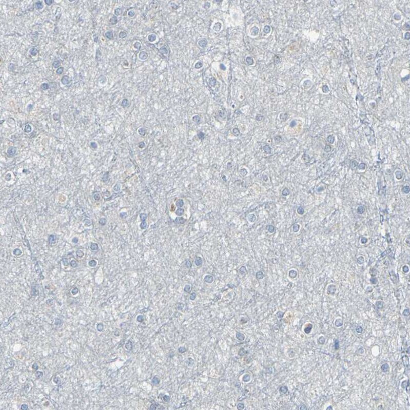 Glycophorin C Antibody - BSA Free Immunohistochemistry-Paraffin: Glycophorin C Antibody [NBP1-84597]