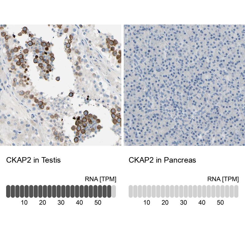 CKAP2 Antibody - BSA Free Immunohistochemistry-Paraffin: CKAP2 Antibody - BSA Free [NBP1-84602]