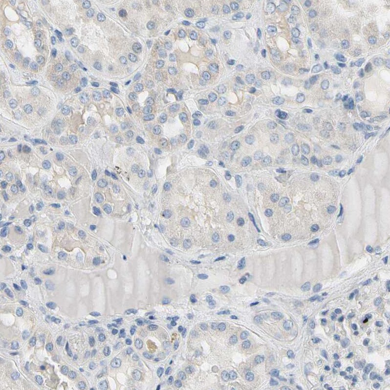 CKAP2 Antibody - BSA Free Immunohistochemistry-Paraffin: CKAP2 Antibody - BSA Free [NBP1-84602]