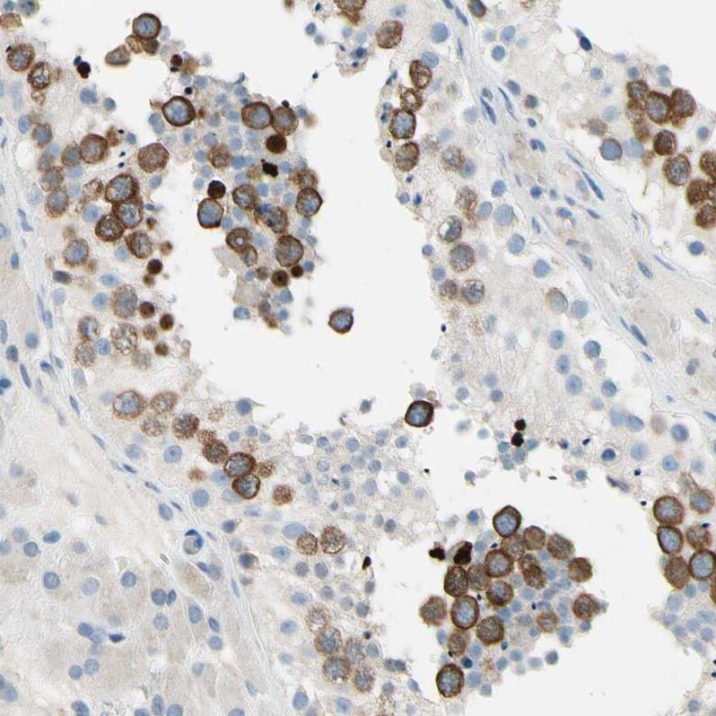 CKAP2 Antibody - BSA Free Immunohistochemistry-Paraffin: CKAP2 Antibody - BSA Free [NBP1-84602]