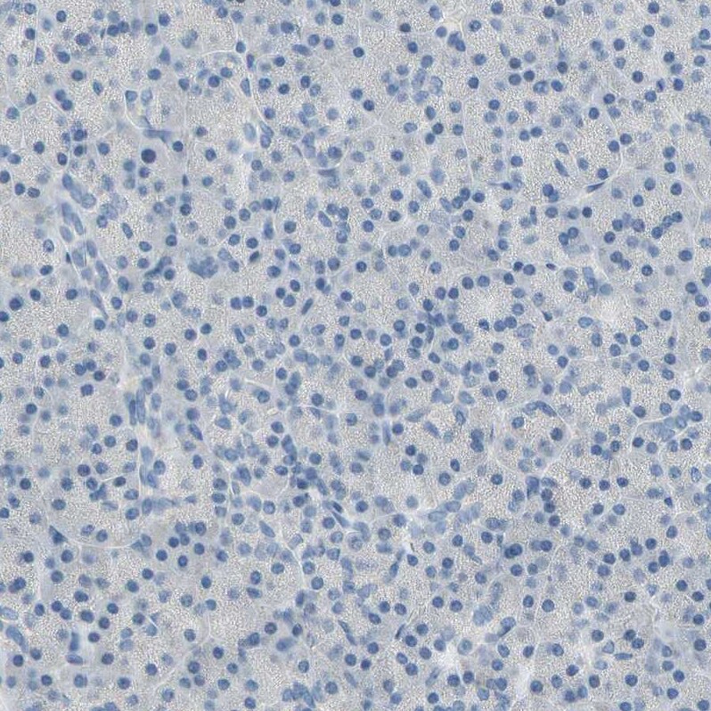 CKAP2 Antibody - BSA Free Immunohistochemistry-Paraffin: CKAP2 Antibody - BSA Free [NBP1-84602]