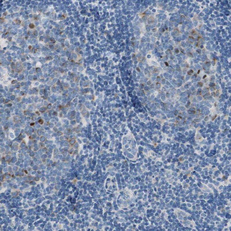 CKAP2 Antibody - BSA Free Immunohistochemistry-Paraffin: CKAP2 Antibody - BSA Free [NBP1-84602]
