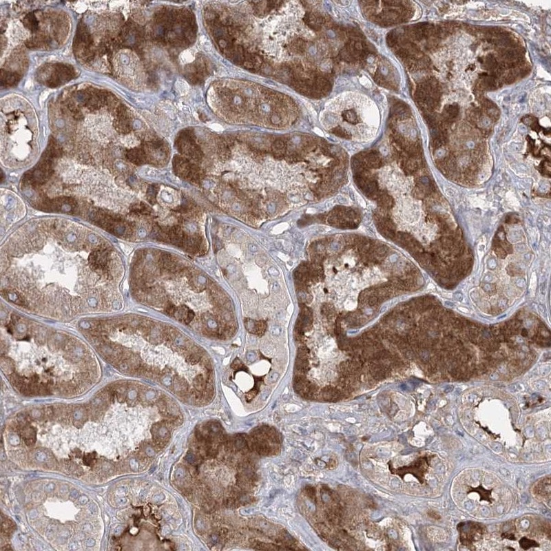 PEPP2 Antibody - BSA Free Immunohistochemistry: PEPP2 Antibody - BSA Free [NBP1-84611]