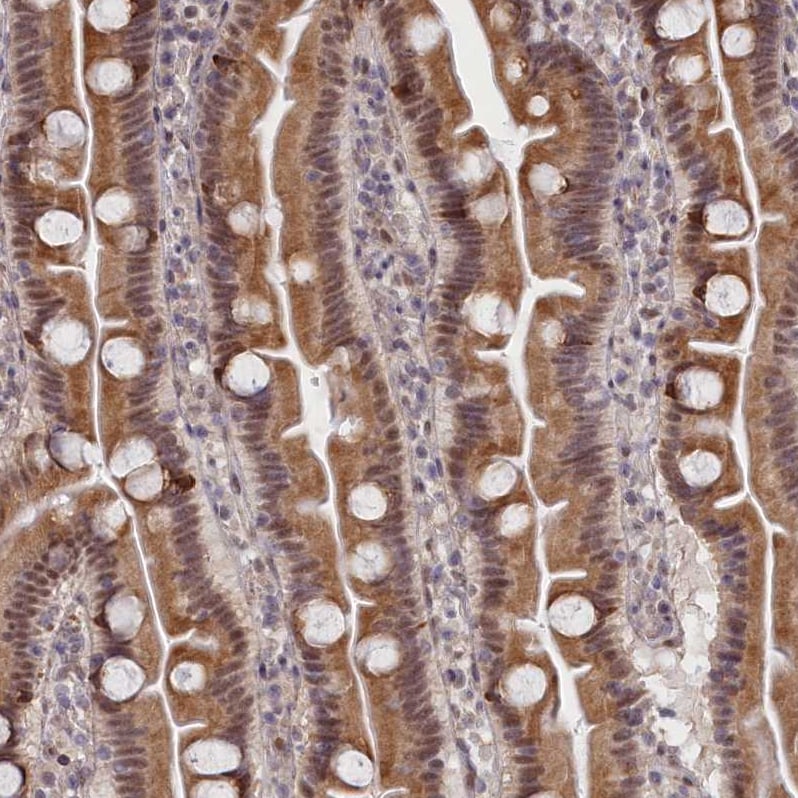 DNAJC17 Antibody - BSA Free Immunohistochemistry-Paraffin: DNAJC17 Antibody [NBP1-84614]