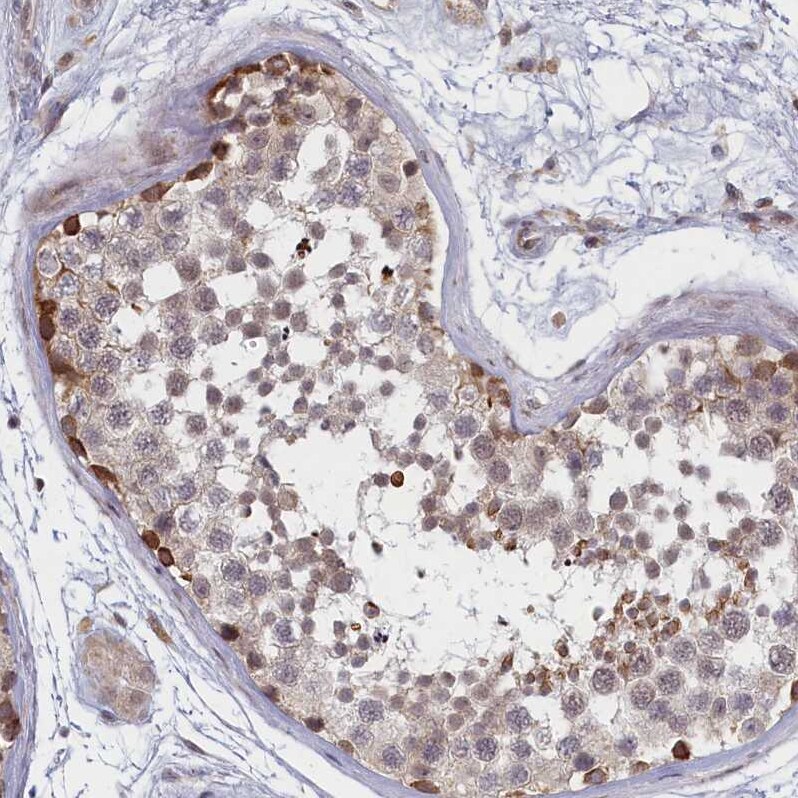 DNAJC17 Antibody - BSA Free Immunohistochemistry-Paraffin: DNAJC17 Antibody [NBP1-84614]