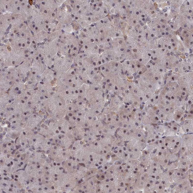 DNAJC17 Antibody - BSA Free Immunohistochemistry-Paraffin: DNAJC17 Antibody [NBP1-84614]