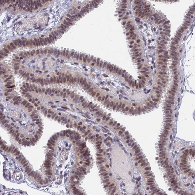DNAJC17 Antibody - BSA Free Immunohistochemistry-Paraffin: DNAJC17 Antibody [NBP1-84614]
