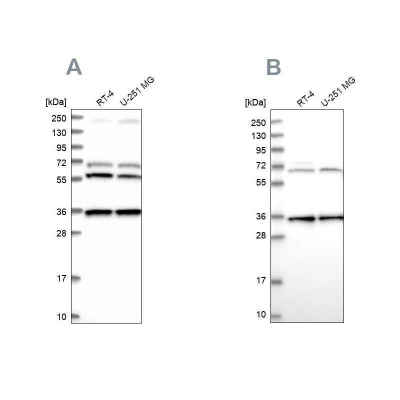 DNAJC17 Antibody - BSA Free Western Blot: DNAJC17 Antibody - BSA Free [NBP1-84614]