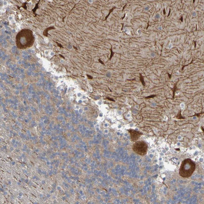 NAV2 Antibody - BSA Free Immunohistochemistry-Paraffin: NAV2 Antibody [NBP1-84615]