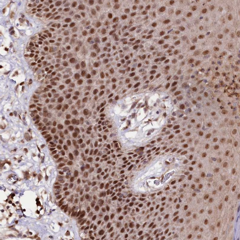 GNL3L Antibody - BSA Free Immunohistochemistry-Paraffin: GNL3L Antibody - BSA Free [NBP1-84618]
