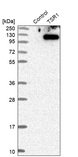 TSR1 Antibody - BSA Free Western Blot: TSR1 Antibody - BSA Free [NBP1-84619]