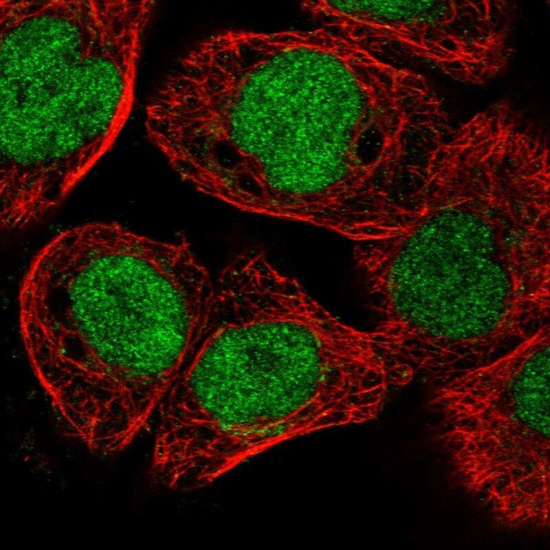 ELAC2 Antibody - BSA Free Immunocytochemistry/ Immunofluorescence: ELAC2 Antibody [NBP1-84620]