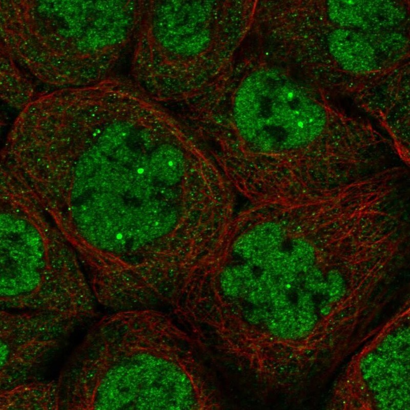 DALRD3 Antibody - BSA Free Immunocytochemistry/ Immunofluorescence: DALRD3 Antibody [NBP1-84622]