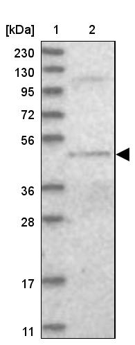 DALRD3 Antibody - BSA Free Western Blot: DALRD3 Antibody - BSA Free [NBP1-84622]