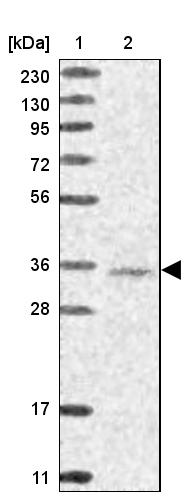 WDR74 Antibody - BSA Free Western Blot: WDR74 Antibody - BSA Free [NBP1-84623]