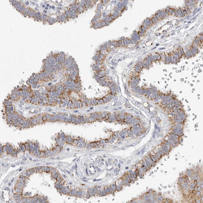 Elp3 Antibody - BSA Free Immunohistochemistry-Paraffin: Elp3 Antibody [NBP1-84625]