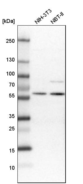 Elp3 Antibody - BSA Free Western Blot: Elp3 Antibody - BSA Free [NBP1-84625]