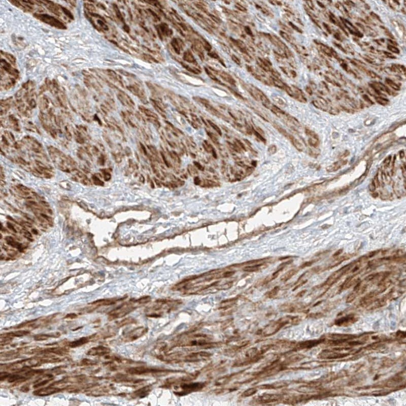 ANKZF1 Antibody - BSA Free Immunohistochemistry-Paraffin: ANKZF1 Antibody [NBP1-84627]