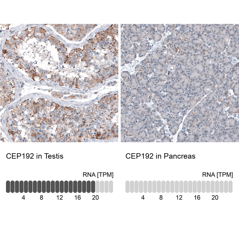 CEP192 Antibody - BSA Free Immunohistochemistry-Paraffin: CEP192 Antibody [NBP1-84634]