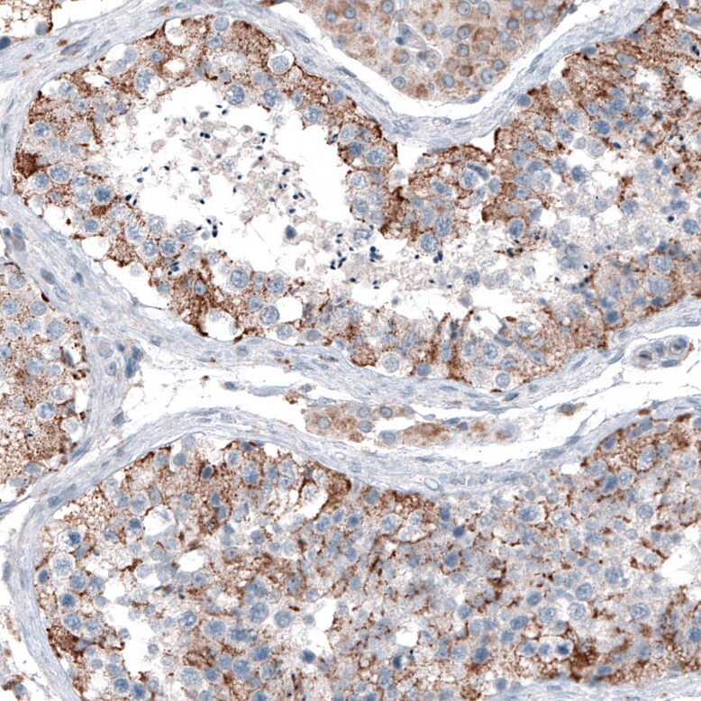 CEP192 Antibody - BSA Free Immunohistochemistry-Paraffin: CEP192 Antibody [NBP1-84634]