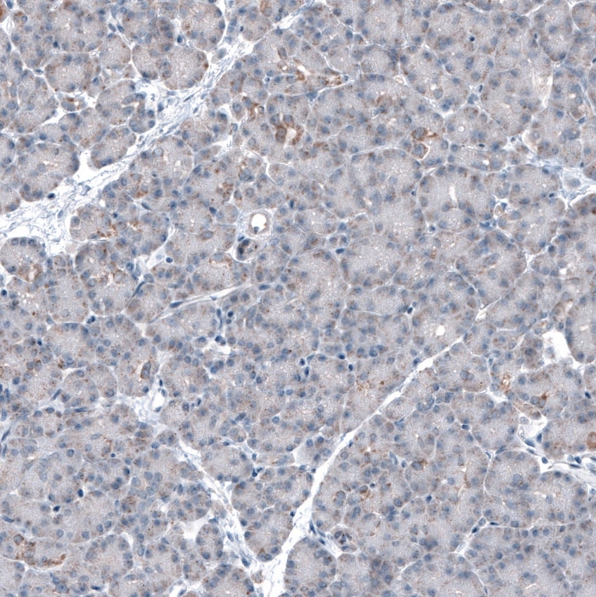 CEP192 Antibody - BSA Free Immunohistochemistry-Paraffin: CEP192 Antibody [NBP1-84634]