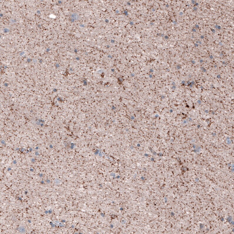 CEP192 Antibody - BSA Free Immunohistochemistry-Paraffin: CEP192 Antibody [NBP1-84634]