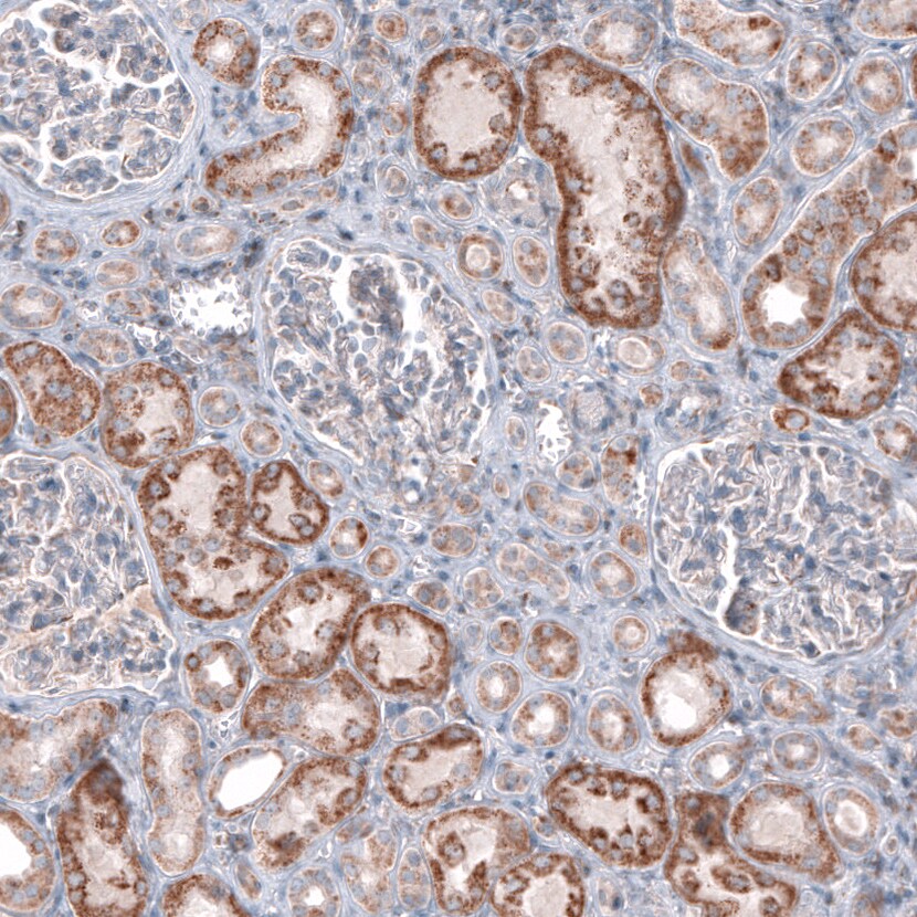 CEP192 Antibody - BSA Free Immunohistochemistry-Paraffin: CEP192 Antibody [NBP1-84634]