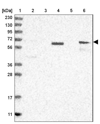 RALGPS2 Antibody - BSA Free Western Blot: RALGPS2 Antibody - BSA Free [NBP1-84645]