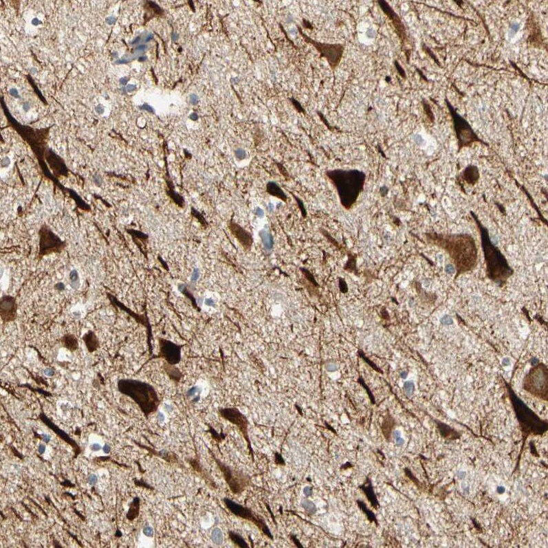 ANKHD1 Antibody - BSA Free Immunohistochemistry-Paraffin: ANKHD1 Antibody - BSA Free [NBP1-84650]
