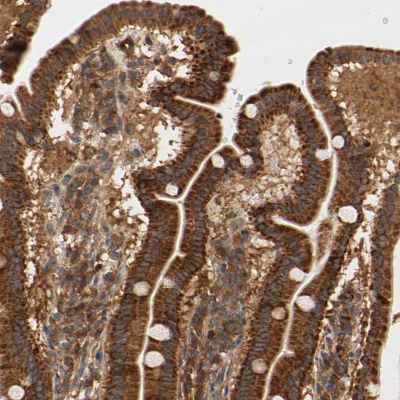 ANKHD1 Antibody - BSA Free Immunohistochemistry-Paraffin: ANKHD1 Antibody - BSA Free [NBP1-84650]