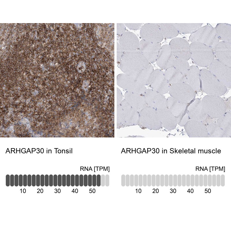 ARHGAP30 Antibody - BSA Free Immunohistochemistry-Paraffin: ARHGAP30 Antibody - BSA Free [NBP1-84653]