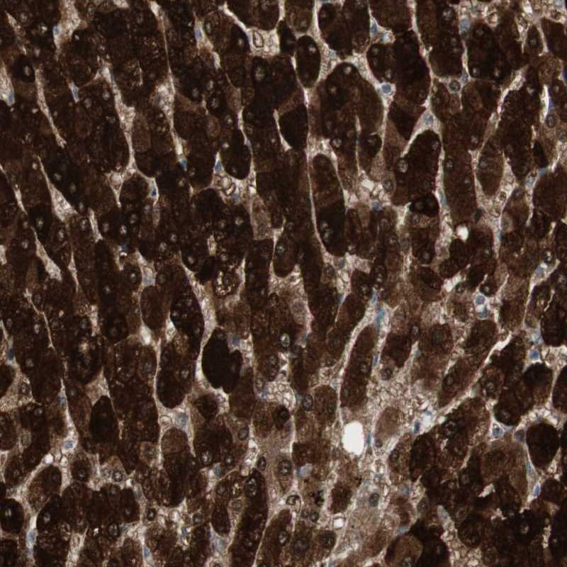 HGK/MAP4K4 Antibody - BSA Free Immunohistochemistry-Paraffin: HGK/MAP4K4 Antibody [NBP1-84663]