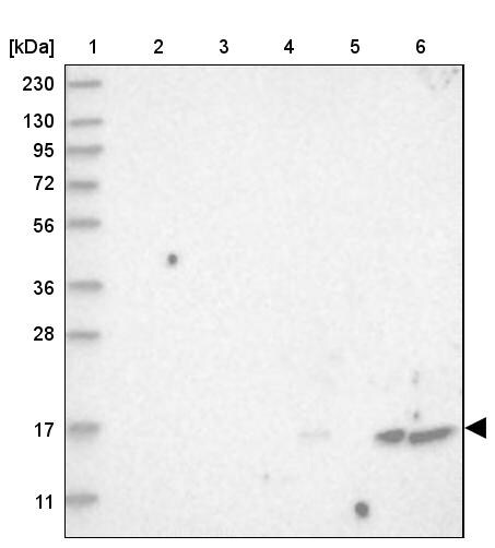 FLAP Antibody - BSA Free Western Blot: FLAP Antibody - BSA Free [NBP1-84666]