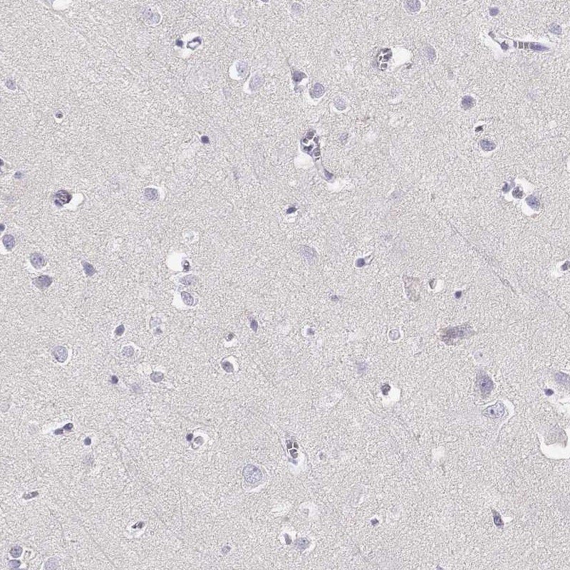 GPR174 Antibody - BSA Free Immunohistochemistry: GPR174 Antibody - BSA Free [NBP1-84667]