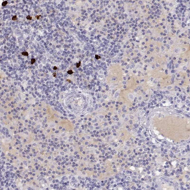GPR174 Antibody - BSA Free Immunohistochemistry: GPR174 Antibody - BSA Free [NBP1-84667]